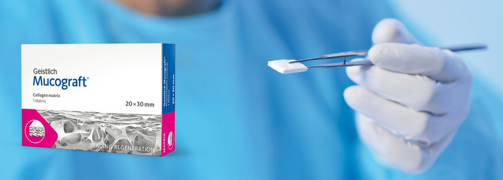 Geistlich Mucograft Seal Collagen Matrix - Beetle Dental Uncategorized (Image 3)
