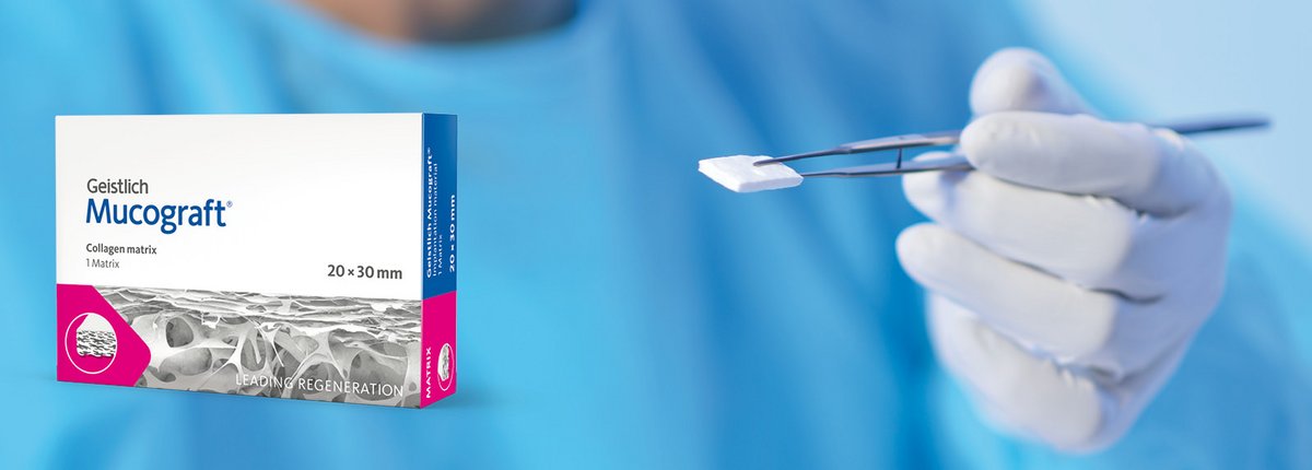 Geistlich Mucograft Seal Collagen Matrix - Beetle Dental Uncategorized (Image 3)