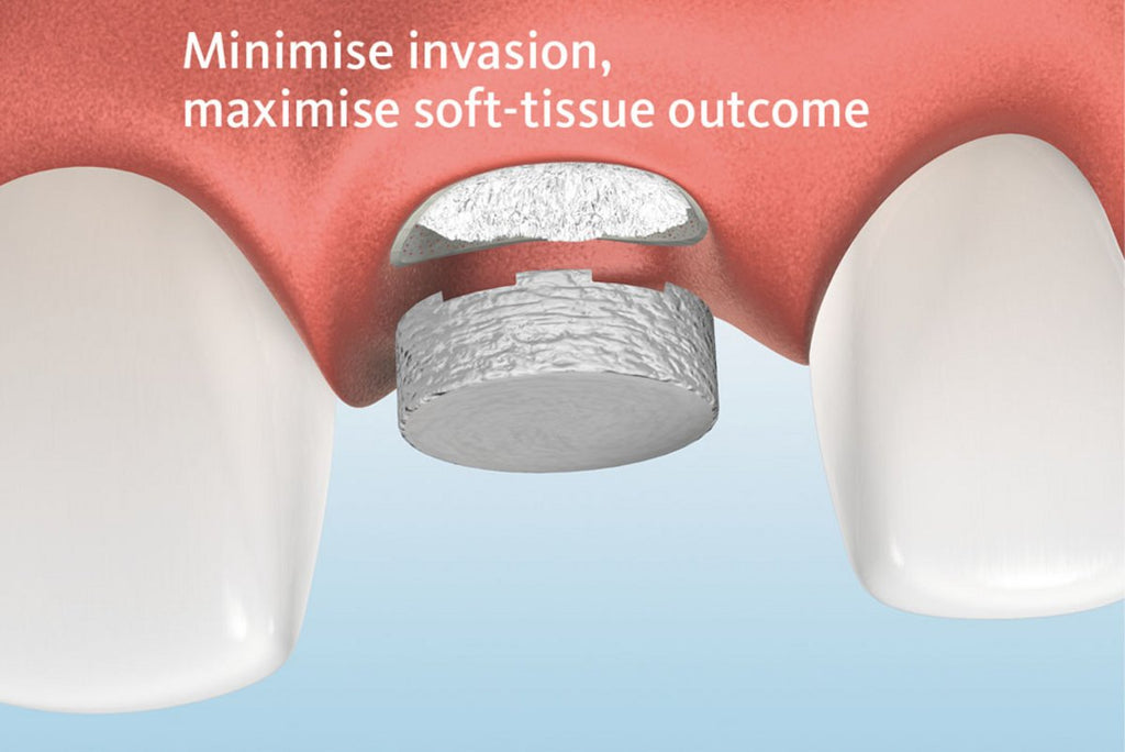 Geistlich Mucograft Seal Collagen Matrix - Beetle Dental Uncategorized (Image 2)